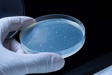 Petri dish with bacterial colonies or molds. Round lab equipment with blue solid sample held in...