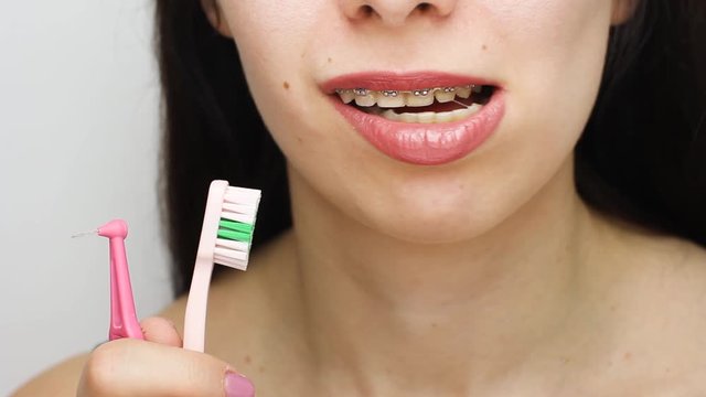 Two types of brush for cleaning teeth with dental braces. Brackets on the teeth after whitening. Self-ligating brackets with metal ties and gray elastics or rubber bands for perfect smile. Orthodontic