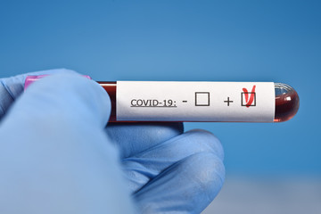 Obraz premium sciences santé virus grippe coronavirus covid-19