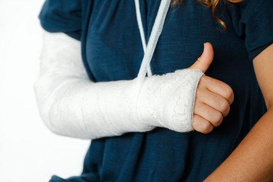 Broken arm in a cast and bandage young red-haired woman sits on bed in medical hospital after manipulations of medical worker and shows sign with hand with finger up