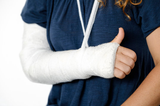 Broken arm in a cast and bandage young red-haired woman sits on bed in medical hospital after manipulations of medical worker and shows sign with hand with finger up