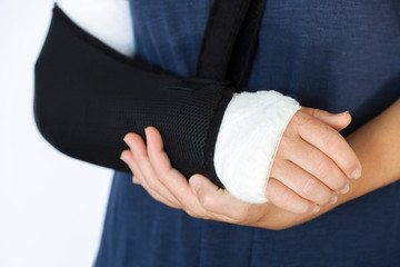 Young woman with broken arm in cast and bandage sits on bed in medical hospital after the manipulations of medical worker. Accident. Orthopedic problem. Lifestyle. People