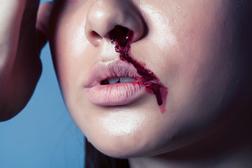problem depressioned teenager with bleeding nose, real junky close up mainstream angry concept,...