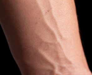 veins on a male hand as a background