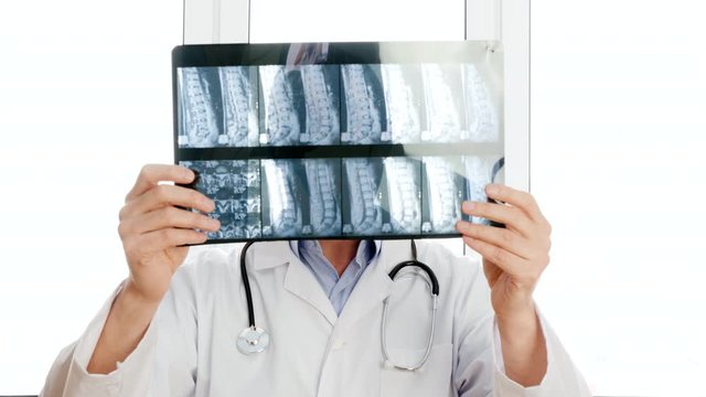 Male doctor looking x-ray of backbones and negatively shaking head. Portrait surgeon watching spine bones and saying no. Medical worker in white medical gown with phonendoscope holding x-ray