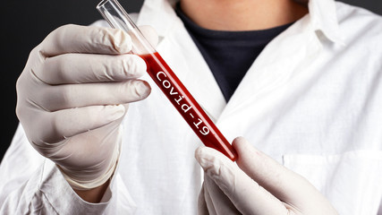 doctor holds test tube with blood infected covid-19 virus. coronavirus pandemic epidemic.