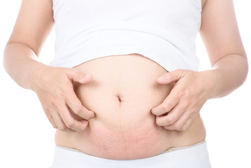  itch and pain of pregnant belly