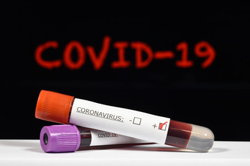 coronavirus  COVID-19  n-CoV santé virus