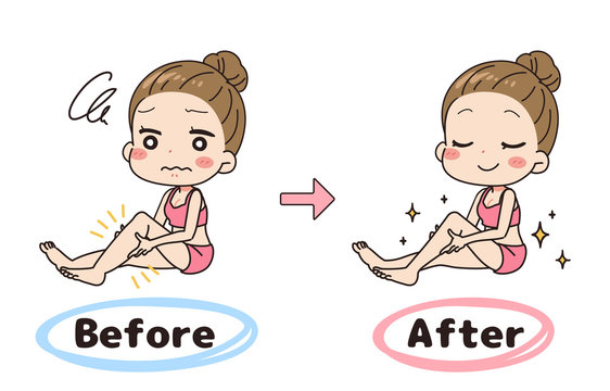 Set illustration, before and after of a woman who is worried about swelling.