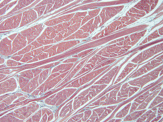 Histology of human tissue, show  epithelial tissue and connective tissue with microscope view  from...