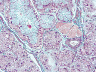 picture of histology human tissue with microscope from laboratory (not Illustration Designation)