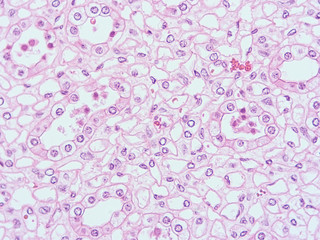 picture of histology human tissue with microscope from laboratory (not Illustration Designation)
