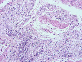 picture of histology human tissue with microscope from laboratory (not Illustration Designation)