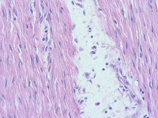 picture of histology human tissue with microscope from laboratory (not Illustration Designation)
