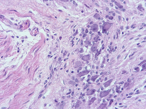 picture of histology human tissue with microscope from laboratory (not Illustration Designation)