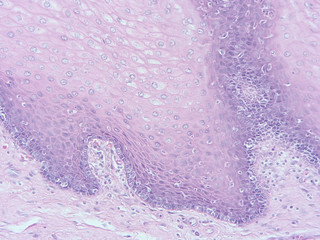 picture of histology human tissue with microscope from laboratory (not Illustration Designation)
