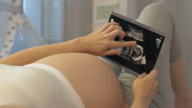 Expectant mother looks at a picture of her unborn child. Utrasound examination of the fetus in hands of a pregnant woman. The nine months of pregnancy, conceptual footage