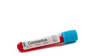 Macro blood sample in test tube on white background. Epidemic Mers-CoV Coronavirus researching and treatment concept
