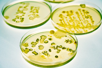 Mixed of bacteria colonies and fungus in various petri dish