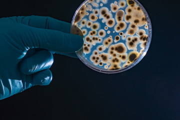 petri dish with microbe colony in doctor hand