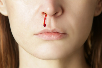 Nosebleed, a young woman with a bloody nose. Healthcare and medical concept. Close up studio image.