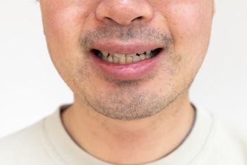 Obraz premium 無精ひげの男の口元