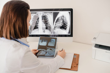 Obraz na płótnie Canvas Young woman radiologist doctor analysis x-ray