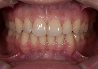 Obraz premium picture of the human jaw macro