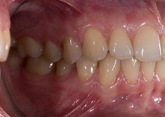 Obraz premium picture of the human jaw macro