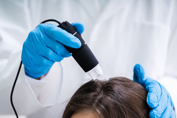 Dermatologist Using Trichoscope For Hair Fall Treatment