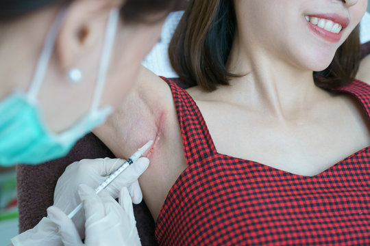 Closeup doctor injection treatment for keloids on the armpit.