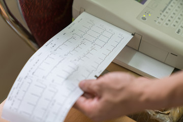 Printing of cardiogram report coming out from Electrocardiograph in labour ward