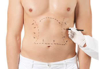 Fototapeta na wymiar Plastic surgeon applying marking on male body against white background