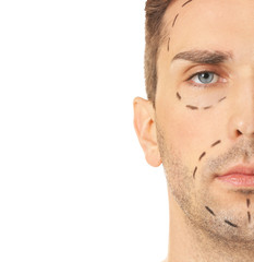 Fototapeta premium Young man with marks on his face against white background. Concept of plastic surgery