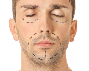 Obraz premium Young man with marks on his face against white background, closeup. Concept of plastic surgery
