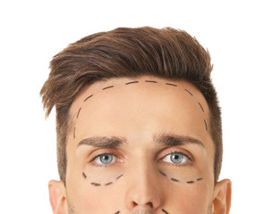 Young man with marks on his face against white background, closeup. Concept of plastic surgery