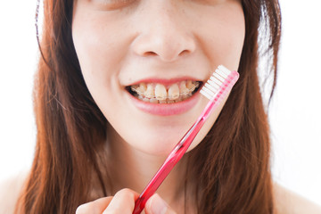 歯列矯正をする若い女性