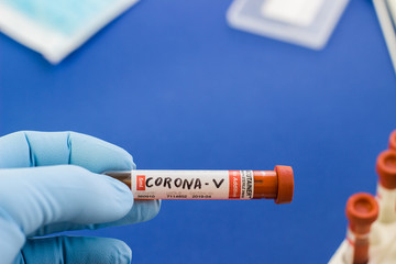 Fototapeta premium blood test tube to examine the corona virus