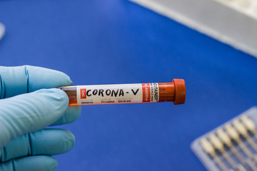 Obraz premium blood test tube to examine the corona virus
