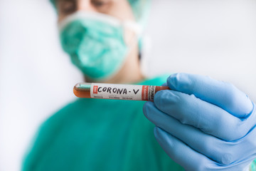 Doctor holds a blood test tube to examine the corona virus