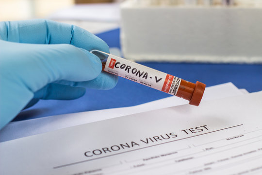blood test tube to examine the corona virus