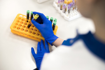 Scientist taking tube with blood sample for laboratory research