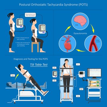 Postural Orthostatic Tachycardia Syndrome POTS Intolerance Tilt Table Test Dysautonomia Low Volume Diagnosed Measure Pulse Abnormal Fast Vessels Fainting Lightheadedness Dizziness Procedure Breathing