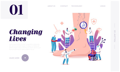 Vein Thrombosis, Varicose Treatment Landing Page Template. Tiny Doctor Characters with Medical Instruments and Drugs at Huge Foot with Diseased Veins, Health Care. Cartoon People Vector Illustration