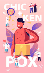 Chicken Pox Varicella Concept. Tiny Doctors Characters near Huge Boy with Red Pimples on Body. People Vaccination, Prevention and Immunization Medical Poster Banner Flyer. Cartoon Vector Illustration