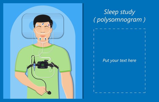 PSG Sleep Study Test Apnea Diagnose Periodic Limb Movement Disorder Positive Airway Pressure CPAP Restless Leg Syndrome Epworth Sleepiness Scale