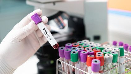 Coronavirus Covid 19 infected blood sample in sample tube in hand of scientist doctor biohazard protection clothing in coronavirus covid 19 research laboratory, Coronavirus Covid-19 vaccine research