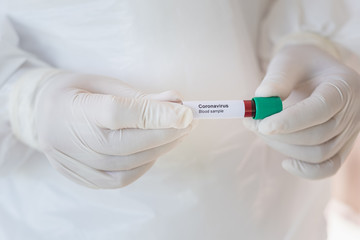 Asian male doctor holding Covid-19 Blood Sample on White Background