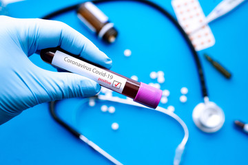 Doctor hand in medical glove  holding tube with positive blood test result for rapidly spreading...