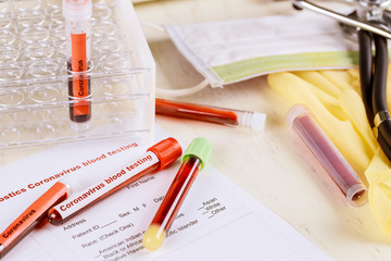 Medical working with blood sample in COVID-19 coronavirus laboratory